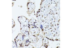 Immunohistochemistry of paraffin-embedded human placenta using HNRNPL antibody (ABIN6128048, ABIN6141915, ABIN6141917 and ABIN6216076) at dilution of 1:100 (40x lens). (HNRNPL Antikörper  (AA 282-589))