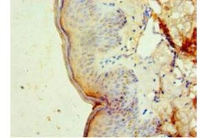 Immunohistochemistry of paraffin-embedded human skin tissue using ABIN7150514 at dilution of 1:100