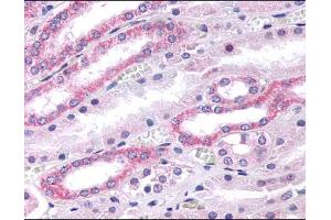 Kidney renal tubules stained with ABIN121986 (Serotonin Receptor 2B Antikörper  (N-Term))