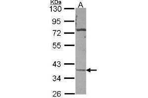 WB Image Sample (30 ug of whole cell lysate) A: A431 , 10% SDS PAGE antibody diluted at 1:500 (CA11 Antikörper)