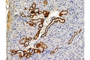 ABIN7096237 and ABIN7100299 at 1/100 staining mouse kidney tissue by IHC-P. (CXORF23 Antikörper)