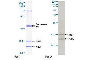 MSK1 Protein (AA 1-549) (GST tag)