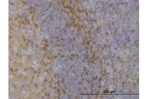 Immunoperoxidase of monoclonal antibody to MAPK12 on formalin-fixed paraffin-embedded human tonsil. (MAPK12 Antikörper  (AA 251-367))