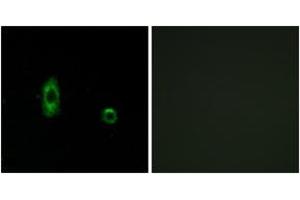 Immunofluorescence analysis of A549 cells, using CXG2 Antibody. (GJC2 Antikörper  (AA 21-70))