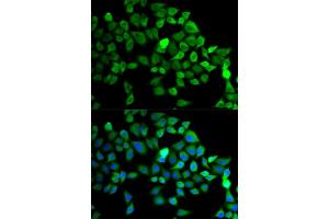 Immunofluorescence analysis of MCF-7 cells using CUL2 antibody (ABIN5975808). (Cullin 2 Antikörper)