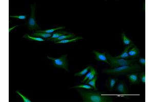 Immunofluorescence of purified MaxPab antibody to C13orf18 on HeLa cell. (C13orf18 Antikörper  (AA 1-595))