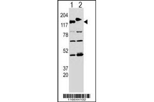 Western blot analysis of CLASP using rabbit polyclonal CLASP Antibody (Y1019) using 293 cell lysates transfected with the ACADL gene (Lane 1) and with the GFP-CLASP (Lane 2). (CLASP2 Antikörper  (AA 998-1026))