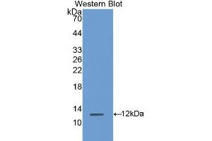 Detection of Recombinant S100A8, Rat using Polyclonal Antibody to S100 Calcium Binding Protein A8 (S100A8) (S100A8 Antikörper  (AA 1-89))