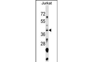 Western blot analysis in Jurkat cell line lysates (35ug/lane). (SNAPC1 Antikörper  (AA 139-168))