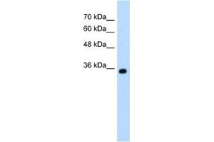 Western Blot showing ZMYND11 antibody used at a concentration of 1-2 ug/ml to detect its target protein. (ZMYND11 Antikörper  (N-Term))