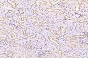 Immunohistochemistry analysis of paraffin-embedded rat kidney using,Fastkd3 (ABIN7073917) at dilution of 1: 3000