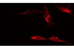 ABIN6274510 staining Hela cells by IF/ICC. (Sema4a Antikörper  (Internal Region))