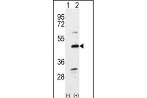 Western blot analysis of Bmp7 (arrow) using rabbit polyclonal Bmp7 Antibody (N-term) (ABIN388457 and ABIN2848828).