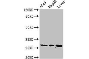 Western Blot Positive WB detected in: A549 whole cell lysate, HepG2 whole cell lysate, Rat liver tissue All lanes: PSMA5 antibody at 3 μg/mL Secondary Goat polyclonal to rabbit IgG at 1/50000 dilution Predicted band size: 27, 21 kDa Observed band size: 27 kDa (PSMA5 Antikörper  (AA 124-180))