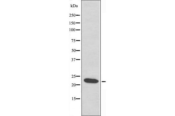 LDOC1L Antikörper