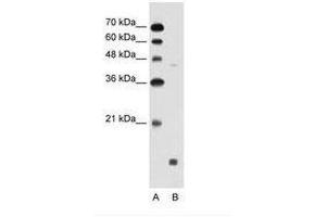 Image no. 1 for anti-Sphingosine-1-Phosphate Receptor 5 (S1PR5) (N-Term) antibody (ABIN6736643) (S1PR5 Antikörper  (N-Term))