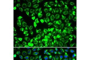 Immunofluorescence analysis of HeLa cells using DLD Polyclonal Antibody (DLD Antikörper)