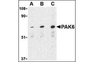 Western blot analysis of PAK6 in Raji lysate with this product at (A) 1, (B) 2, and (C) 4 μg/ml.