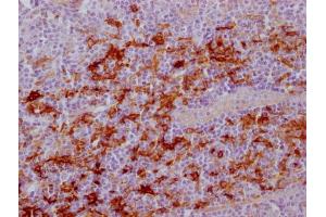 IHC image of ABIN7181209 diluted at 1:100 and staining in paraffin-embedded human tonsil tissue performed on a Leica BondTM system. (Fascin Antikörper)