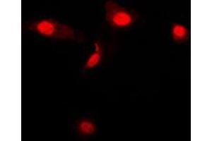 Immunofluorescent analysis of Galectin 3 staining in Jurkat cells. (Galectin 3 Antikörper  (Center))