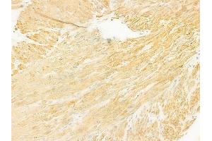 ABIN6260835 and ABIN6272548 at 1/100 staining human normal gastric tissue by IHC-P.