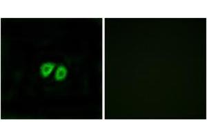 Immunofluorescence analysis of MCF7 cells, using GPR56 Antibody. (GPR56 Antikörper  (AA 251-300))