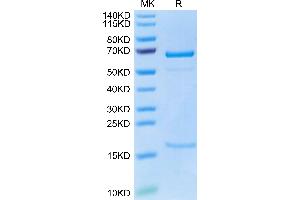 SDS-PAGE (SDS) image for Proprotein Convertase Subtilisin/kexin Type 9 (PCSK9) (AA 151-811) protein (His tag) (ABIN7275414)