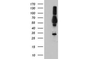 Western Blotting (WB) image for anti-Tubby Like Protein 3 (TULP3) antibody (ABIN1501585) (TULP3 Antikörper)