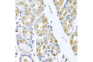 Immunohistochemistry of paraffin-embedded human stomach using TMEM43 antibody. (TMEM43 Antikörper  (AA 80-310))