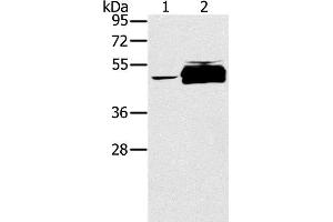 Western Blot analysis of K562 cell and Human testis tissue using PTPN20 Polyclonal Antibody at dilution of 1:200 (PTPN20 Antikörper)