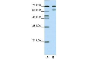 WB Suggested Anti-TCF3 Antibody Titration:  0. (TCF3 Antikörper  (N-Term))