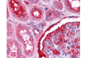 Immunohistochemistry (IHC) image for anti-Nuclear Receptor Subfamily 4, Group A, Member 2 (NR4A2) (N-Term) antibody (ABIN2780752)