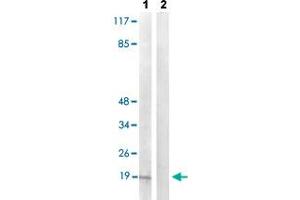 Western blot analysis of Lane 1: TNF treated COS-7 cells, Lane 2: antigen-specific peptide treated COS-7 cells with PEA15 (phospho S104) polyclonal antibody  at 1:500-1:1000 dilution. (PEA15 Antikörper  (pSer104))