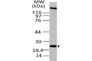 Image no. 1 for anti-Oxidized Low Density Lipoprotein (Lectin-Like) Receptor 1 (OLR1) (AA 1-200) antibody (ABIN5027116) (OLR1 Antikörper  (AA 1-200))