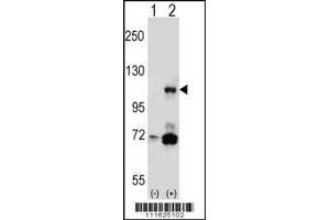 Western blot analysis of PIK3CB using rabbit polyclonal P using 293 cell lysates (2 ug/lane) either nontransfected (Lane 1) or transiently transfected (Lane 2) with the PIK3CB gene. (PIK3CB Antikörper  (N-Term))