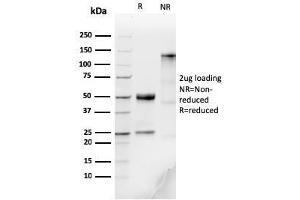 SDS-PAGE Analysis Purified IgM Recombinant Rabbit Monoclonal Antibody (IGHM/3776R). (Rekombinanter IGHM Antikörper)