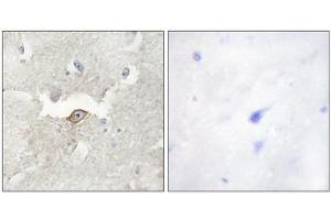 Immunohistochemistry analysis of paraffin-embedded human brain tissue using LMTK2 antibody. (LMTK2 Antikörper  (Internal Region))