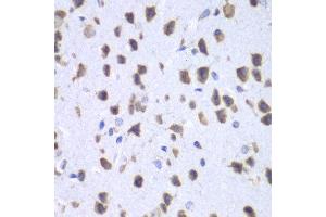Immunohistochemistry of paraffin-embedded mouse brain using UPF1 antibody at dilution of 1:100 (x40 lens). (RENT1/UPF1 Antikörper)