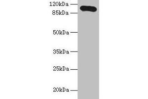 Western blot All lanes: Thbs3 antibody at 16 μg/mL + HepG2 whole cell lysate Secondary Goat polyclonal to rabbit IgG at 1/10000 dilution Predicted band size: 105 kDa Observed band size: 105 kDa (THBS3 Antikörper  (AA 24-350))