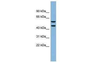 KLHDC4 antibody used at 1 ug/ml to detect target protein. (KLHDC4 Antikörper  (N-Term))