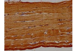 IHC image of ABIN7154440 diluted at 1:30 and staining in paraffin-embedded human skeletal muscle tissue performed on a Leica BondTM system.