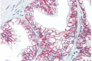 Human Prostate (formalin-fixed, paraffin-embedded) stained with CTNNB1 antibody ABIN364501 at 10 ug/ml followed by biotinylated anti-mouse IgG secondary antibody ABIN481714, alkaline phosphatase-streptavidin and chromogen. (CTNNB1 Antikörper  (C-Term))