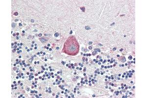 Anti-HOXA10 antibody IHC staining of human brain, cerebellum. (HOXA10 Antikörper  (AA 152-165))