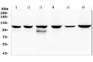 Western blot analysis of PIK3CB using anti-PIK3CB antibody (ABIN5518862).