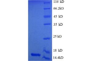 SDS-PAGE (SDS) image for Myostatin (MSTN) (AA 267-375) protein (His tag) (ABIN4974587)