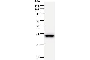 Western Blotting (WB) image for anti-B-Cell CLL/lymphoma 9 (BCL9) antibody (ABIN931006) (BCL9 Antikörper)