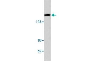 Western blot analysis of Jurkat cell lysate with TOP2B polyclonal antibody . (TOP2B Antikörper)