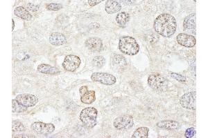 Immunohistochemistry (IHC) image for anti-Nucleoporin 50kDa (NUP50) (AA 418-468) antibody (ABIN7448703) (NUP50 Antikörper  (AA 418-468))