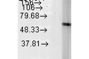 Western Blot analysis of Human Heat Shocked HeLa cell lysates showing detection of Hsp60 protein using Mouse Anti-Hsp60 Monoclonal Antibody, Clone LK-2 . (HSPD1 Antikörper  (Biotin))