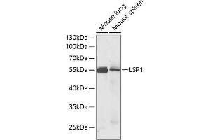 Western blot analysis of extracts of various cell lines, using LSP1 antibody (ABIN6130532, ABIN6143368, ABIN6143370 and ABIN6221252) at 1:1000 dilution. (LSP1 Antikörper  (AA 1-339))